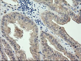 Monoclonal Mouse anti-Human CTAG1B / NY-ESO-1 Antibody (clone OTI4C8, Carrier-free, IHC, IF, WB)