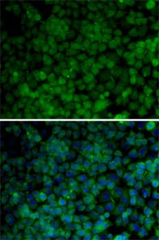 CDK7 Antibody