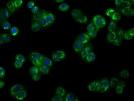 Monoclonal Mouse anti-Human NPR3 Antibody (clone OTI11H6, IHC, IF, WB)