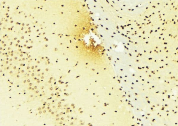 RARA / RAR Alpha Antibody