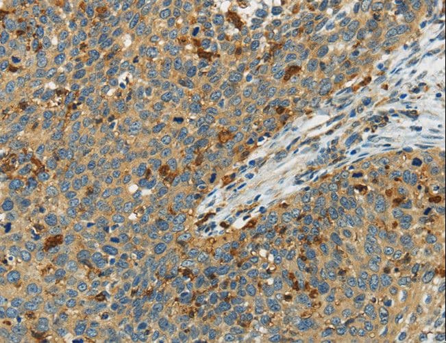 AIF1 / IBA1 Antibody