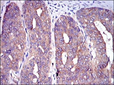 Monoclonal Mouse anti-Human c-CBL Antibody (clone 3B12, IHC, IF, WB)