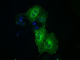 MAP2K1 / MKK1 / MEK1 Antibody (clone OTI1F5)