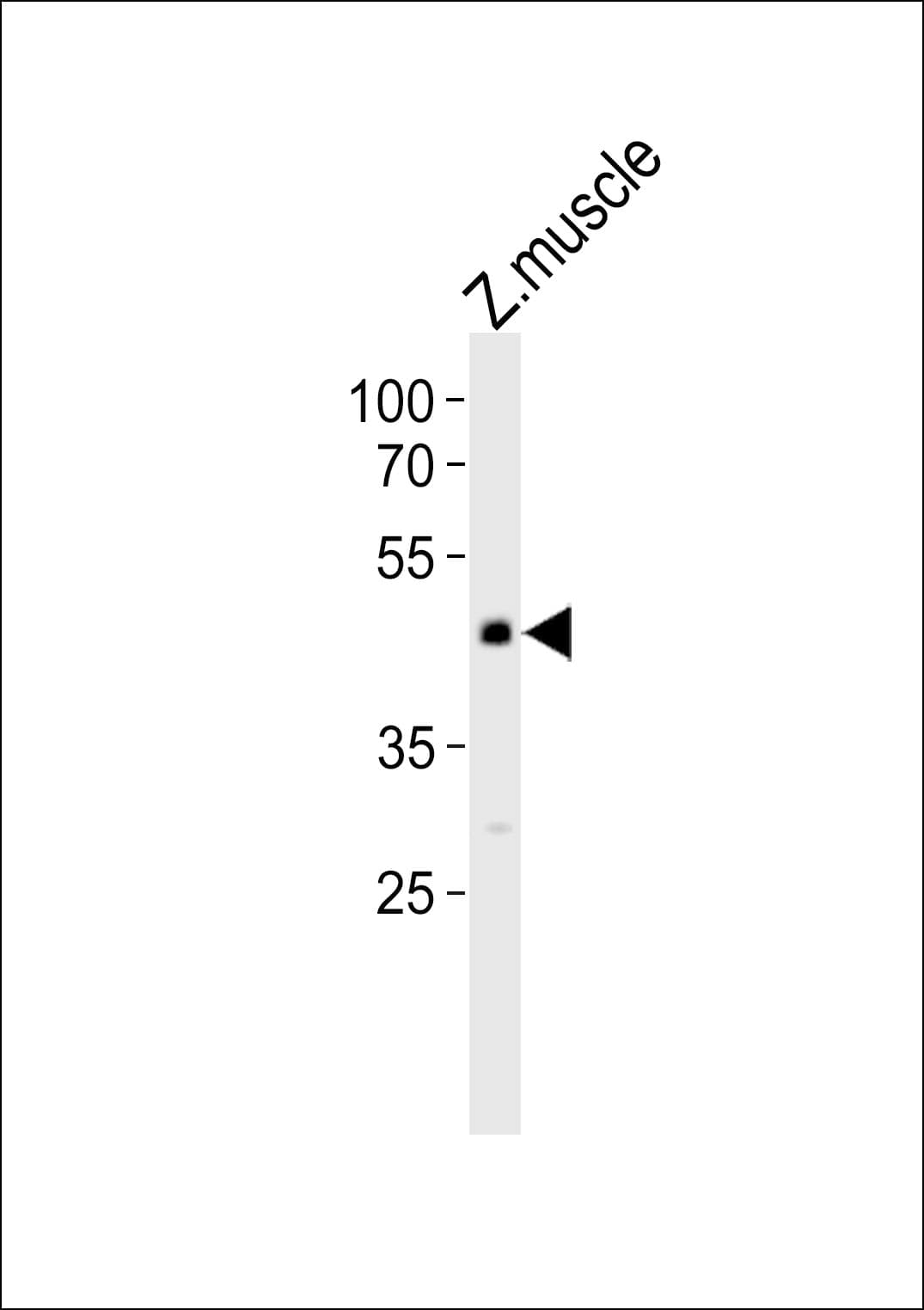 MAPK8 / JNK1 Antibody (aa183-215)