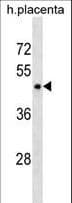 Polyclonal Rabbit anti-Human PLIN3 / M6PRBP1 / TIP47 Antibody (aa230-257, WB)