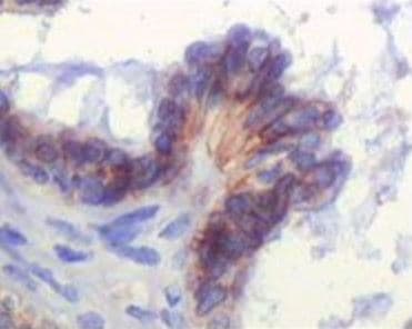 IGF1R / IGF1 Receptor Antibody (clone 3C8B1)