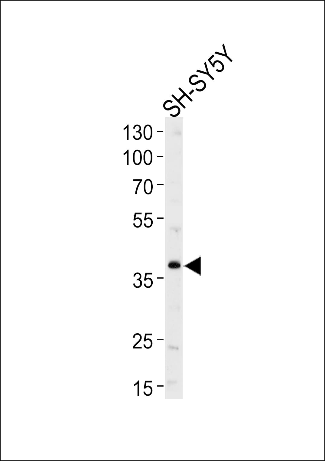 Neuroserpin Antibody (aa19-45)