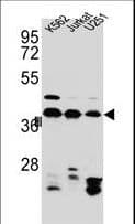 HNRNPC / HNRNP C Antibody (aa279-306)