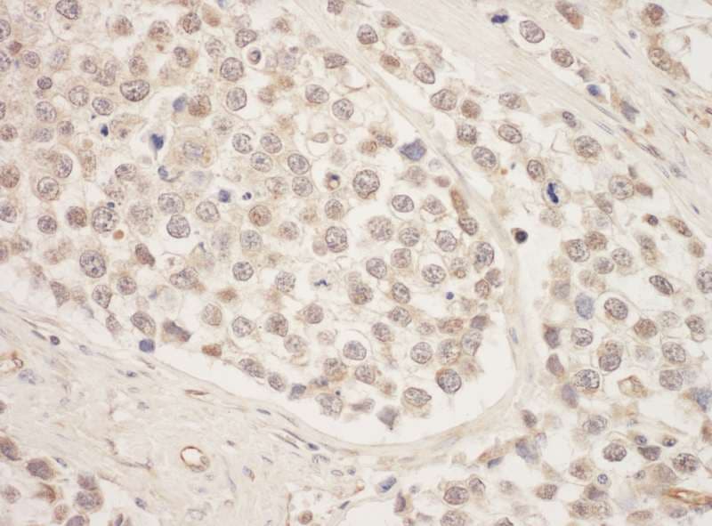 Polyclonal Rabbit anti-Human SRPK1 Antibody (aa275-325, IHC, WB)