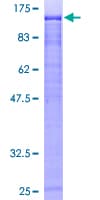 Human ZKSCAN5 Protein (Recombinant GST)
