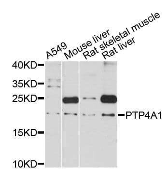 PTP4A1 / PRL-1 Antibody