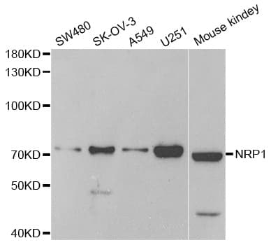 IHC-plus™ NRP1 / Neuropilin 1 Antibody