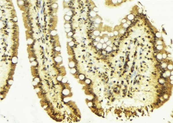 CLU / Clusterin Antibody