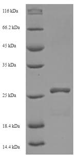 Human HIV-1 Vif Protein (Recombinant 6His, N-terminus)