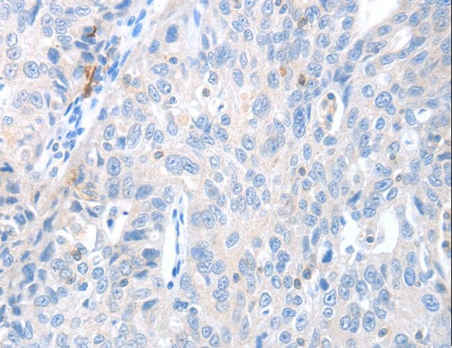 MAGEB4 Antibody