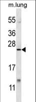 XBP1 Antibody (aa217-244)