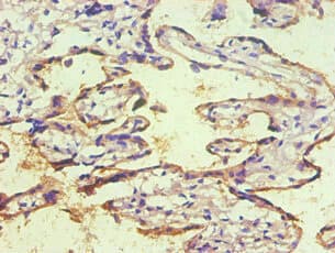 Monoclonal Mouse anti-Human CD59 Antibody (clone 2E11B6, IHC, WB)