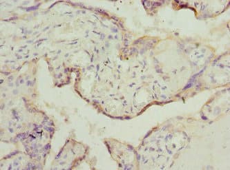 Polyclonal Rabbit anti-Human TESK2 Antibody (IHC)