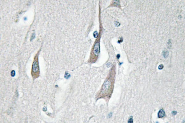 CaMKII Alpha+Delta Antibody (phospho-Thr286)