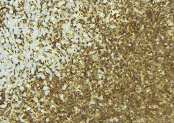 Polyclonal Rabbit anti-Human DOK1 Antibody (IHC, IF, WB)