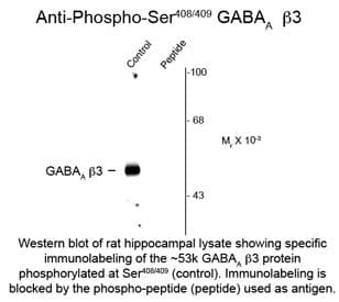 GABRB2 Antibody (phospho-Ser408/Ser409)