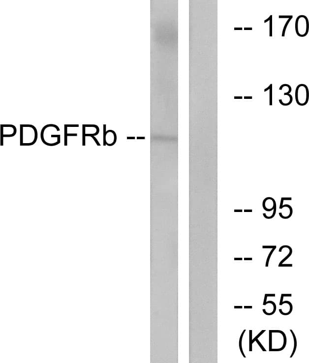 PDGFRB / PDGFR Beta Antibody (aa718-767)