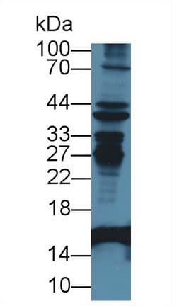 I-FABP / FABP2 Antibody (aa2-132)