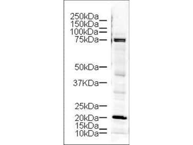 LIMK1 / LIMK Antibody (aa620-647)