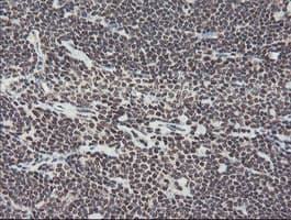Monoclonal Mouse anti-Human TPRKB Antibody (clone OTI1E9, IHC, WB)