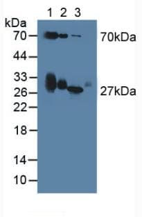 APOD / Apolipoprotein D Antibody (aa1-189)