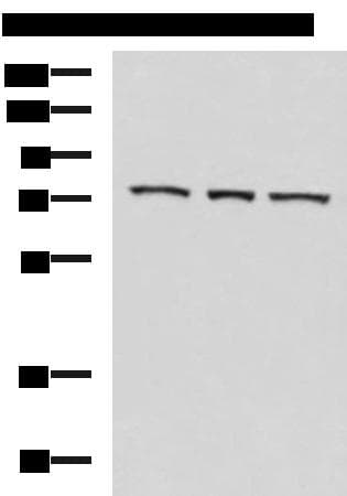 Polyclonal Rabbit anti-Human ABI2B / ABI2 Antibody (WB)