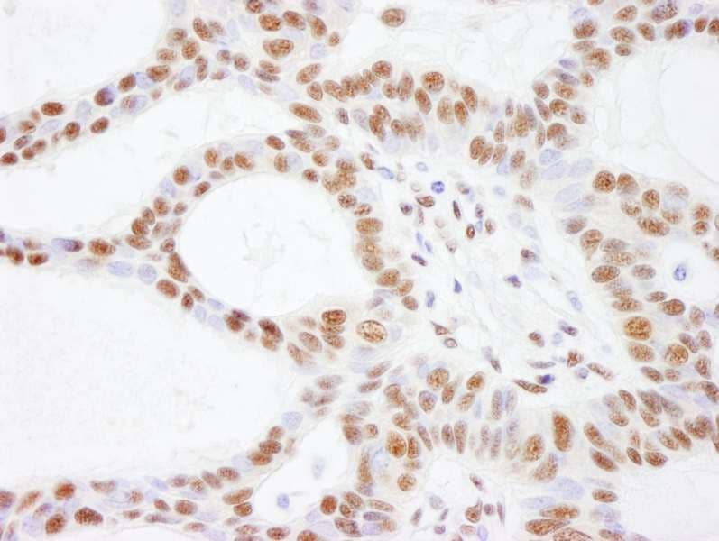 SMARCC2 Antibody (aa1164-C-term)