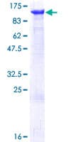 Human MCM6 Protein (Recombinant GST)