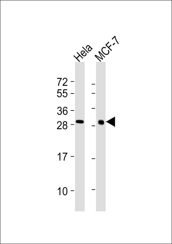 LGALS3 / Galectin 3 Antibody