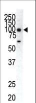 IHC-plus™ EPHA1 / EPH Receptor A1 Antibody (aa913-943)
