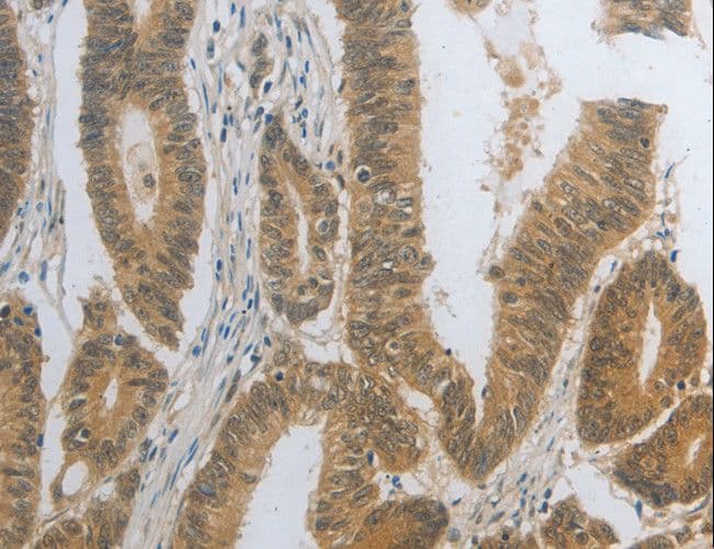 DNAJC7 Antibody