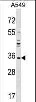UNKL Antibody (aa1-30)