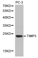 Polyclonal Rabbit anti-Human TIMP3 Antibody (IHC, WB)