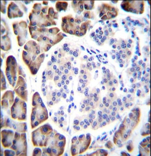 UROC1 Antibody (aa402-430)