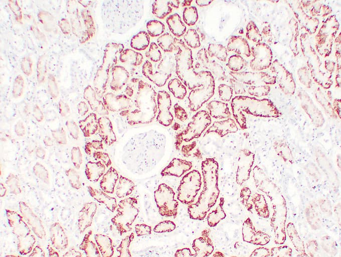 VHL / Von Hippel Lindau Antibody (clone ABT-PVHL)
