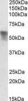 SERPINA6 / CBG Antibody (aa157-170)