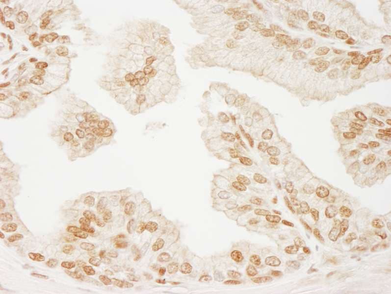 Polyclonal Rabbit anti-Human PML Antibody (aa575-625, IHC, WB)