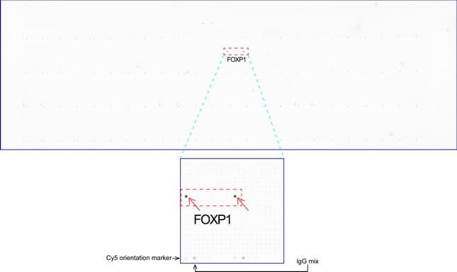 FOXP1 Antibody (clone UMAB89, Carrier-free)