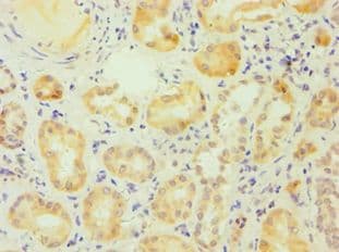 Polyclonal Rabbit anti-Human ESRRA / ERR Alpha Antibody (aa1-423, IHC)