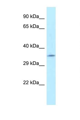 Polyclonal Rabbit anti-Human FAHD2A Antibody (aa28-77, WB)