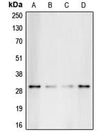 GC1qR / C1QBP Antibody (Internal)
