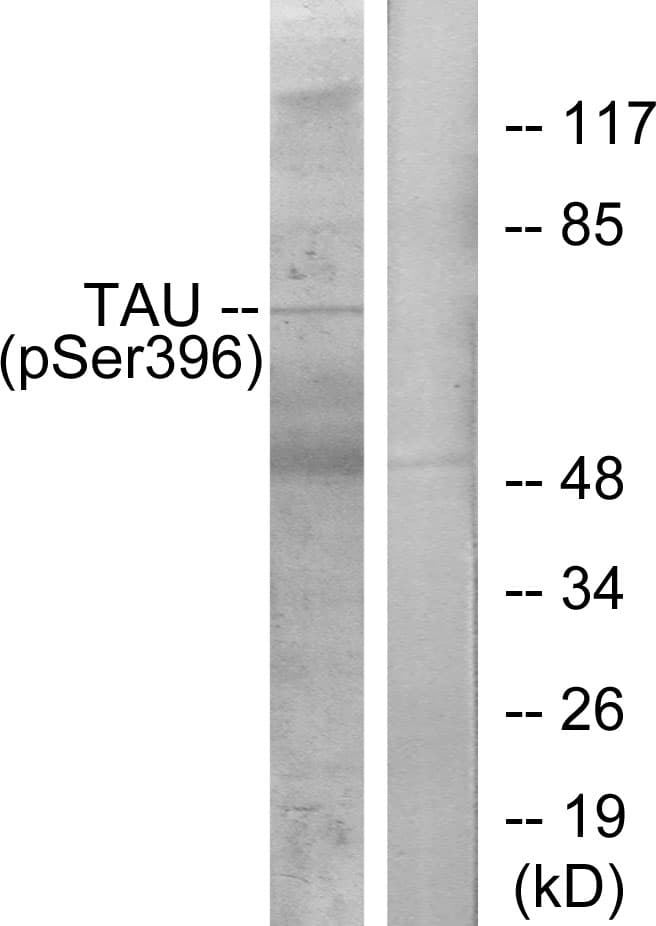 MAPT / Tau Antibody (phospho-Ser396)
