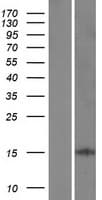 LARP6 / ACHN Protein (Over-Expression Lysate Myc-DDK (Flag))