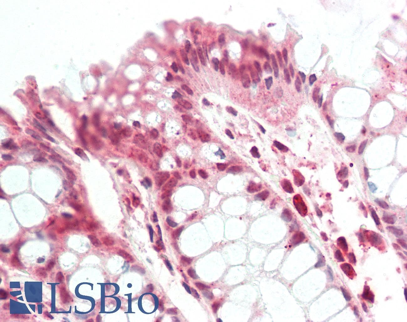 Polyclonal Rabbit anti-Human SMAD1 Antibody (aa153-202, IHC, WB)