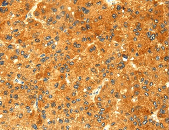 Polyclonal Rabbit anti-Human GALK1 / GK1 Antibody (IHC)